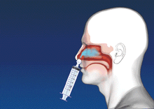 Last inn bildet i Galleri-visningsprogrammet, Neti Rinse neseskyllesprøyte